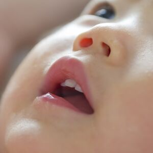 矯正歯科は何歳から始めるべき？