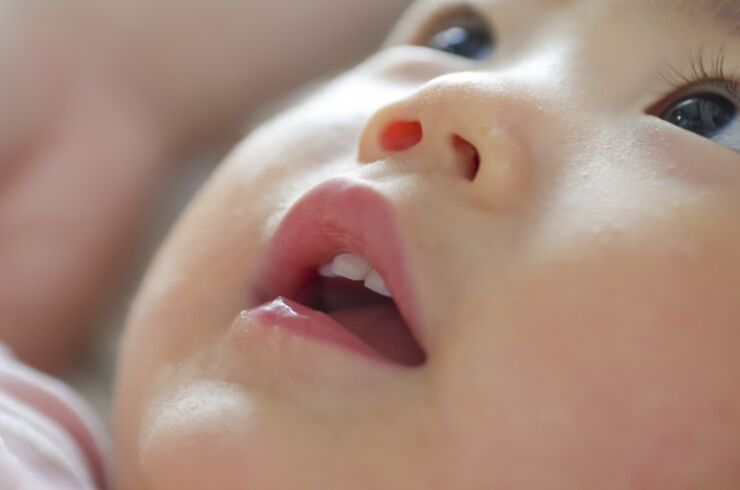 矯正歯科は何歳から始めるべき？